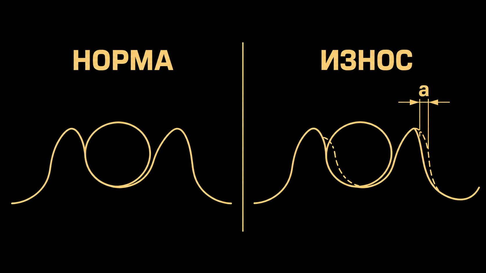 Нормальный и изношенный профиль зуба звезды